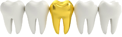 Zähne in einer Reihe mit Goldzahn