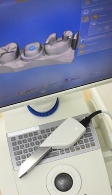 Cerec Computer